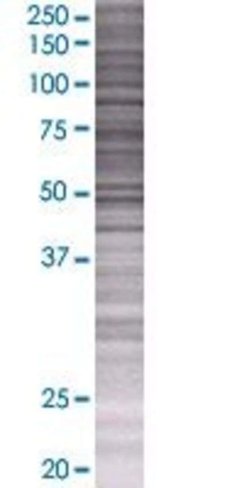 Prlr 293t cell transient overexpres sion lysate (denatured) 100 µl