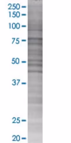 Pros1 293t cell transient overexpre ssion lysate (denatured) 100 µl