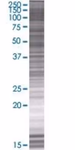 Prpsap2 293t cell transient overexp ression lysate (denatured) 100 µl