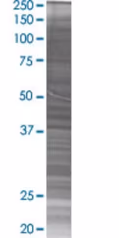 Prss1 293t cell transient overexpre ssion lysate (denatured) 100 µl