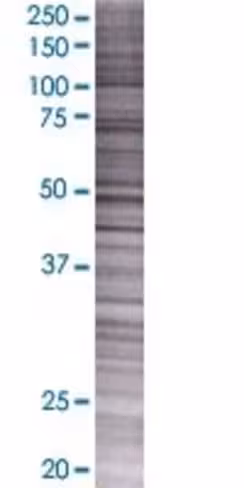 Prss2 293t cell transient overexpre ssion lysate (denatured) 100 µl