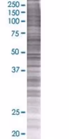 Prss8 293t cell transient overexpre ssion lysate (denatured) 100 µl