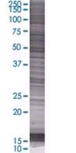 Psap 293t cell transient overexpres sion lysate (denatured) 100 µl