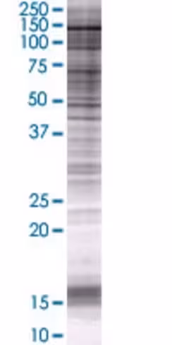 Psd 293t cell transient overexpress ion lysate (denatured) 100 µl