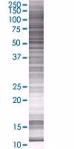 Psg1 293t cell transient overexpres sion lysate (denatured) 100 µl