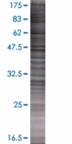 Psg2 293t cell transient overexpres sion lysate (denatured) 100 µl