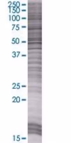 Psg3 293t cell transient overexpres sion lysate (denatured) 100 µl