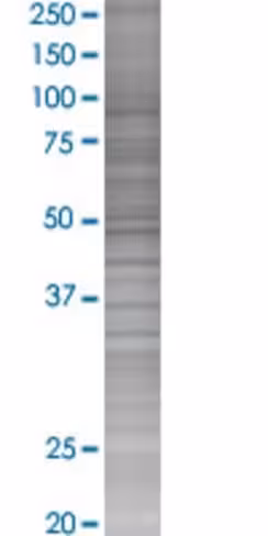 Psg3 293t cell transient overexpres sion lysate (denatured) 100 µl
