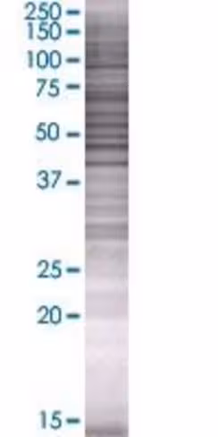 Psg4 293t cell transient overexpres sion lysate (denatured) 100 µl