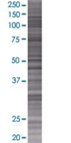 Psg5 293t cell transient overexpres sion lysate (denatured) 100 µl