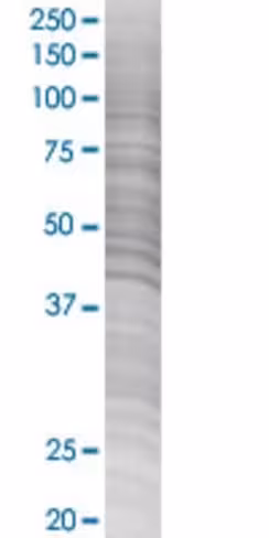 Psg9 293t cell transient overexpres sion lysate (denatured) 100 µl