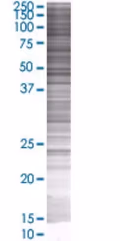 Psg11 293t cell transient overexpre ssion lysate (denatured) 100 µl
