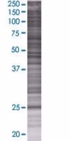 Psma6 293t cell transient overexpre ssion lysate (denatured) 100 µl