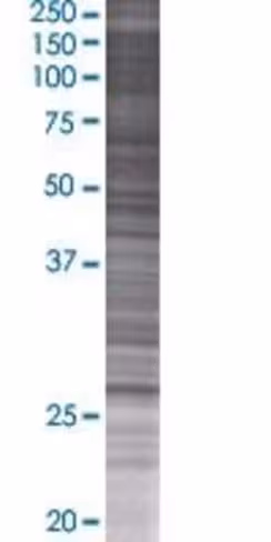 Psmb5 293t cell transient overexpre ssion lysate (denatured) 100 µl