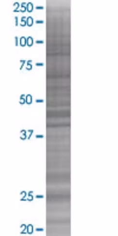 Psmb5 293t cell transient overexpre ssion lysate (denatured) 100 µl