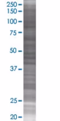 Psmb5 293t cell transient overexpre ssion lysate (denatured) 100 µl