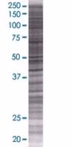 Psmb7 293t cell transient overexpre ssion lysate (denatured) 100 µl