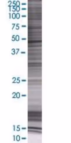 Psmc3 293t cell transient overexpre ssion lysate (denatured) 100 µl