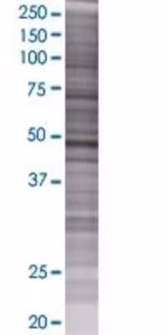 Psmc4 293t cell transient overexpre ssion lysate (denatured) 100 µl