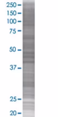 Psmd2 293t cell transient overexpre ssion lysate (denatured) 100 µl