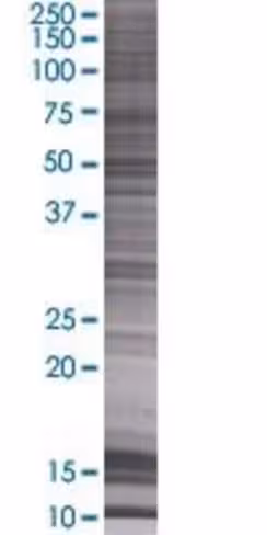 Psmd5 293t cell transient overexpre ssion lysate (denatured) 100 µl