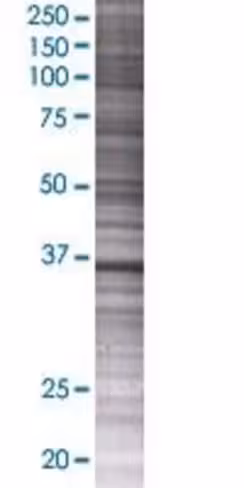 Psmd7 293t cell transient overexpre ssion lysate (denatured) 100 µl