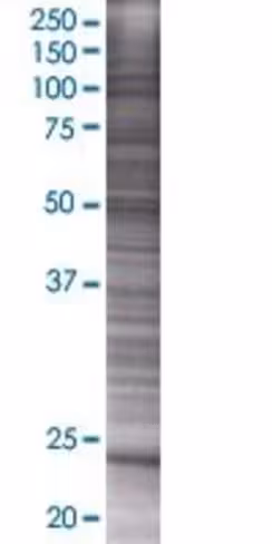 Psmd10 293t cell transient overexpr ession lysate (denatured) 100 µl