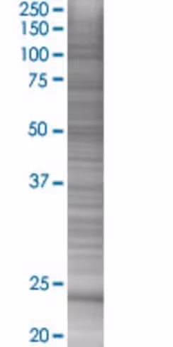 Psmd10 293t cell transient overexpr ession lysate (denatured) 100 µl