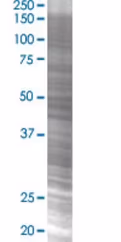 Psmd13 293t cell transient overexpr ession lysate (denatured) 100 µl