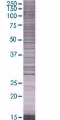Psme1 293t cell transient overexpre ssion lysate (denatured) 100 µl