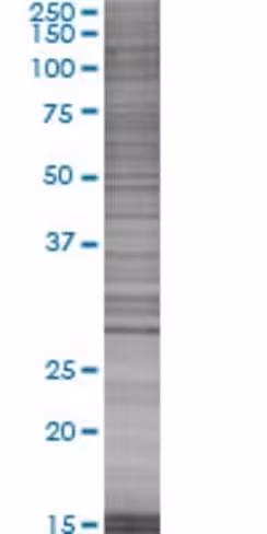 Psme1 293t cell transient overexpre ssion lysate (denatured) 100 µl