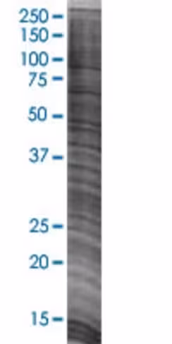 Pten 293t cell transient overexpres sion lysate (denatured) 100 µl