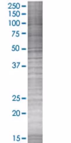 Ptger3 293t cell transient overexpr ession lysate (denatured) 100 µl