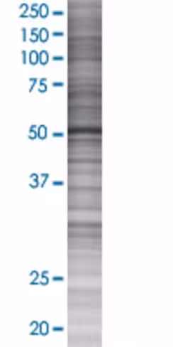 Ptgis 293t cell transient overexpre ssion lysate (denatured) 100 µl