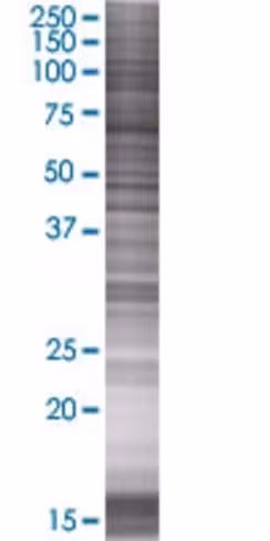 Ptk2 293t cell transient overexpres sion lysate (denatured) 100 µl