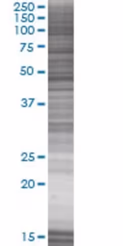 Ptpn1 293t cell transient overexpre ssion lysate (denatured) 100 µl