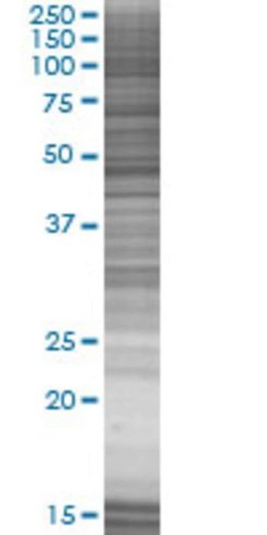 Ptpn1 293t cell transient overexpre ssion lysate (denatured) 100 µl