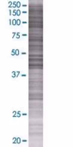Ptpn2 293t cell transient overexpre ssion lysate (denatured) 100 µl