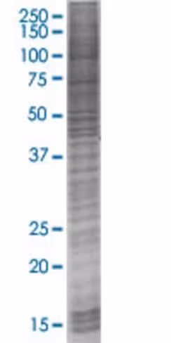 Ptpn2 293t cell transient overexpre ssion lysate (denatured) 100 µl