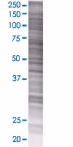 Ptpn7 293t cell transient overexpre ssion lysate (denatured) 100 µl