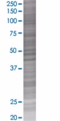 Ptpn7 293t cell transient overexpre ssion lysate (denatured) 100 µl