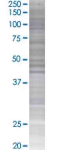 Ptprn 293t cell transient overexpre ssion lysate (denatured) 100 µl