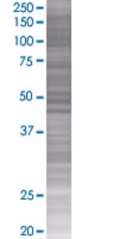Ptprn2 293t cell transient overexpr ession lysate (denatured) 100 µl