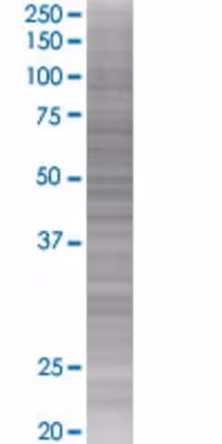 Pvr 293t cell transient overexpress ion lysate (denatured) 100 µl