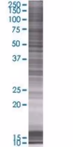 Pex19 293t cell transient overexpre ssion lysate (denatured) 100 µl