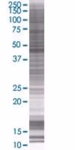 Pcyt2 293t cell transient overexpre ssion lysate (denatured) 100 µl