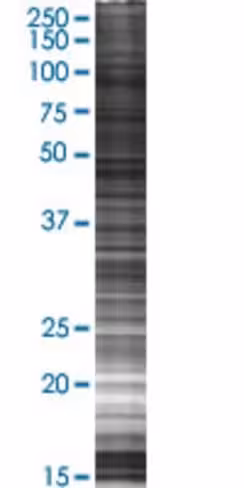 Pygb 293t cell transient overexpres sion lysate (denatured) 100 µl