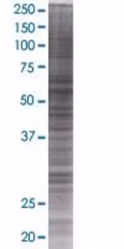 Rabggta 293t cell transient overexp ression lysate (denatured) 100 µl