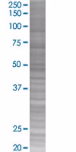 Rad17 293t cell transient overexpre ssion lysate (denatured) 100 µl