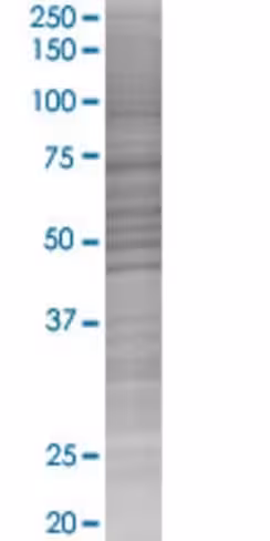 Rad23b 293t cell transient overexpr ession lysate (denatured) 100 µl